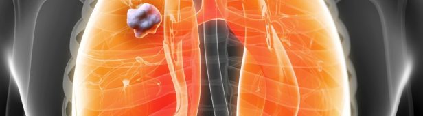 Okay To Live In A House With Radon