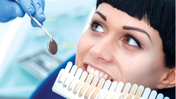 Teeth Whitening