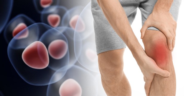 Potential Therapies for Joint Regeneration