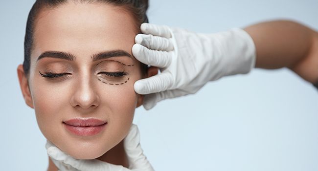 Eyes Need A Blepharoplasty