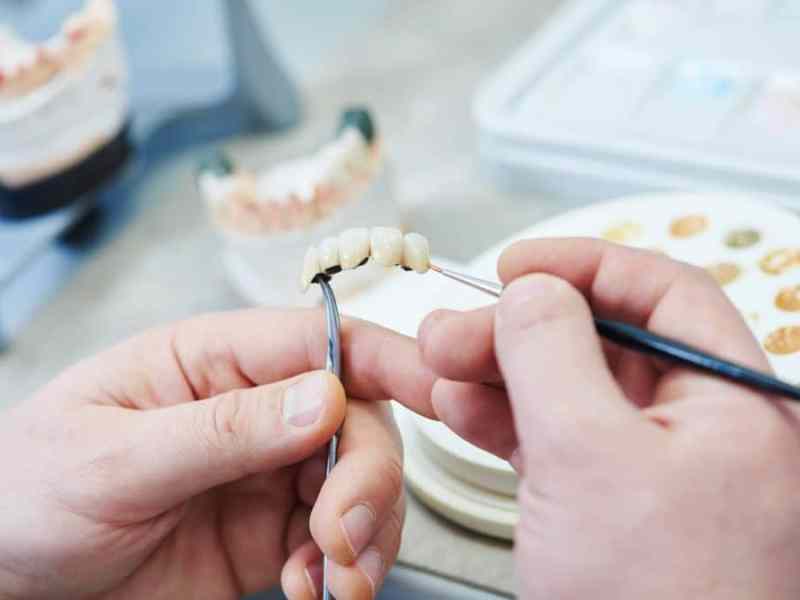 Restoring a Complete Smile With Dental&nbsp;Bridges
