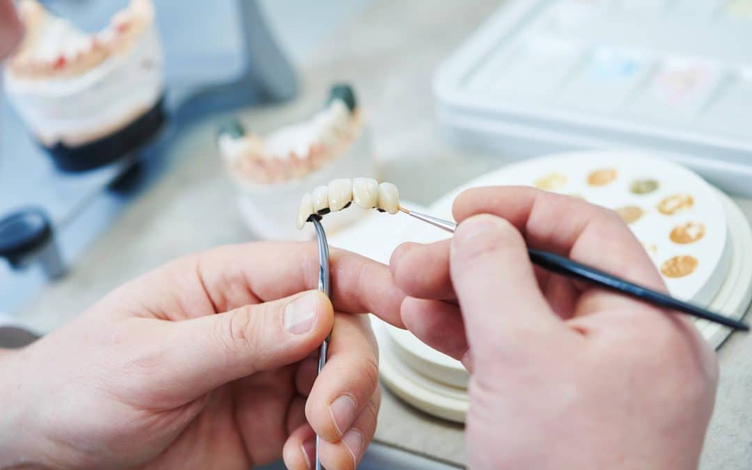 Restoring a Complete Smile With Dental&nbsp;Bridges